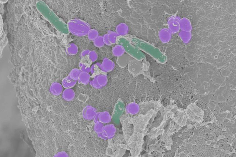 Round and rod-shaped bacteria
